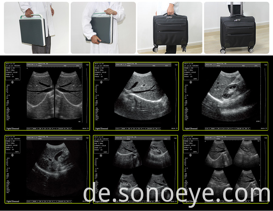 Laptop Ultrasound Scanner with Probe